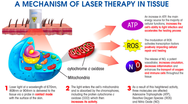 Laser light at a wavelength of 670nm, 808nm or 904nm is delivered to the tissue via a probe. The light enters the cell's mitochondria and is absorbed by the chromophores, including the protein cytochrome c oxidase (CCO) which then increases its activity. As a result of this heightened activity, three molecules are affected: ATP, ROS, and NO. ATP increases the cell's ability to fight infection and accelerates the healing process. The modulation of ROS positively impacts cellular repair and healing. The release of NO increases circulation, decreases inflammation, and enhances the transport of oxygen and immune cells throughout the tissue.